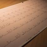 fréquence-cardiaque